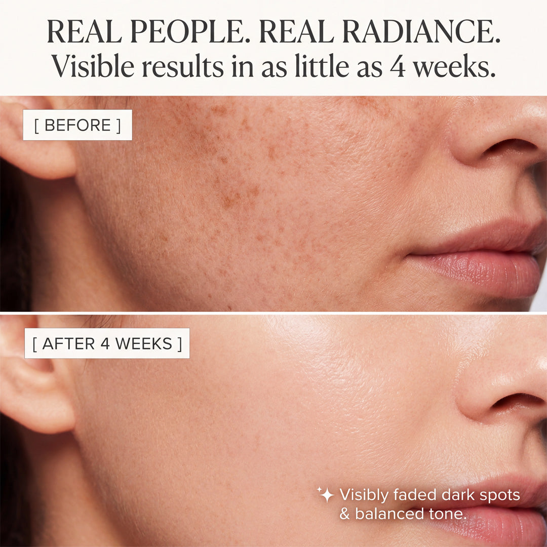 Radiance Complexion Bar: Kojic Acid & Turmeric