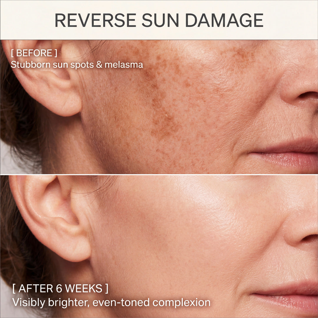 Radiance Complexion Bar: Kojic Acid & Turmeric